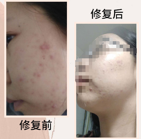 雷火电竞官网首页登录品牌
